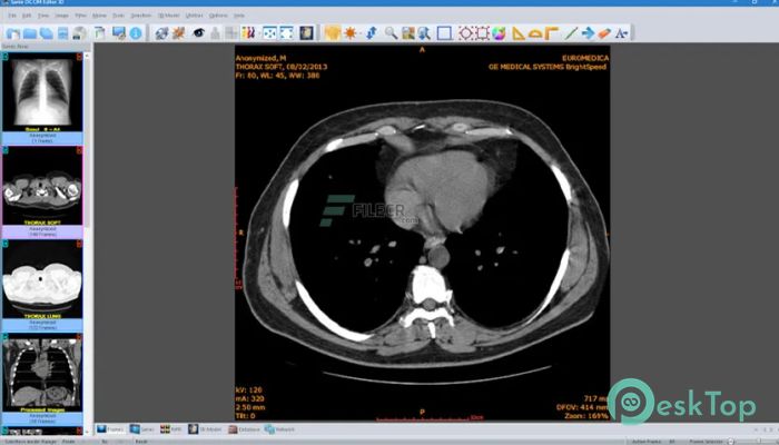 Download Sante DICOM Editor 3D  4.9.4 Free Full Activated