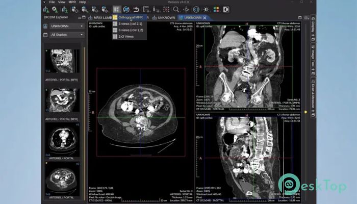 Weasis DICOM Viewer  4.5.1 完全アクティベート版を無料でダウンロード