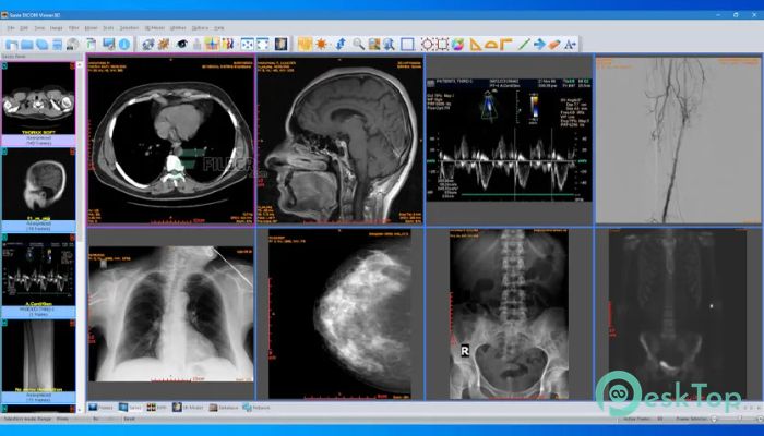 Download Sante DICOM Viewer 3D Pro 4.9.4 Free Full Activated