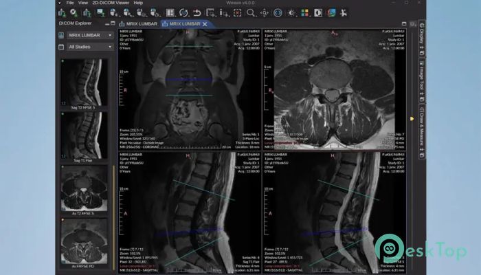 Weasis DICOM Viewer  4.5.1 完全アクティベート版を無料でダウンロード