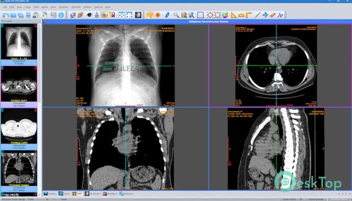 Download Sante DICOM Editor 3D  4.9.4 Free Full Activated