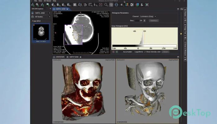Weasis DICOM Viewer  4.5.1 完全アクティベート版を無料でダウンロード