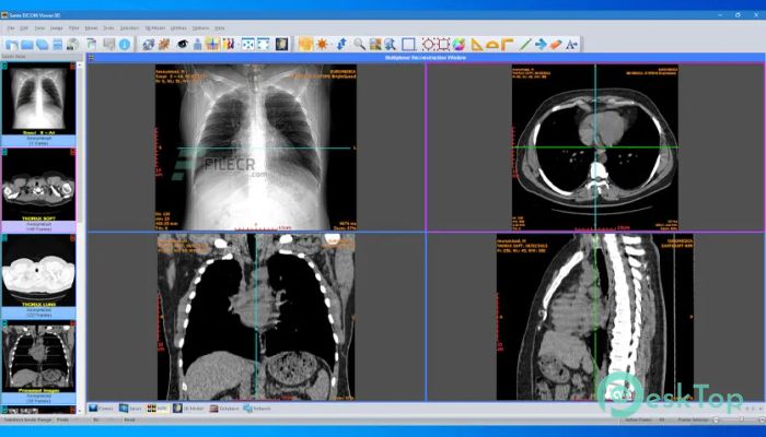 Download Sante DICOM Viewer 3D Pro 4.9.4 Free Full Activated
