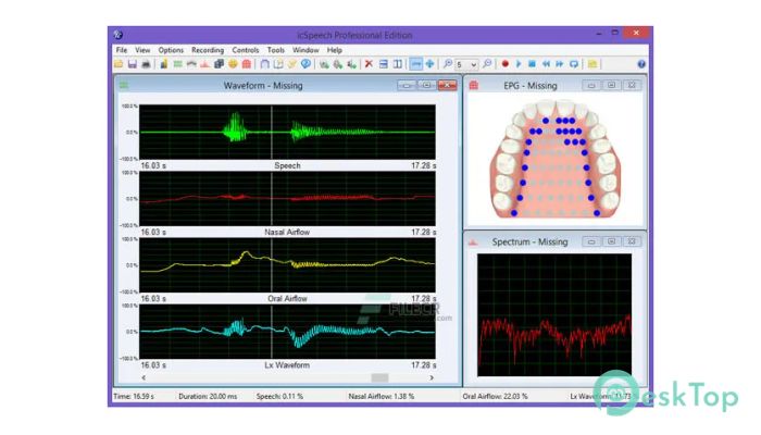 Download RoseMedical icSpeech Professional 3.3.1 Free Full Activated