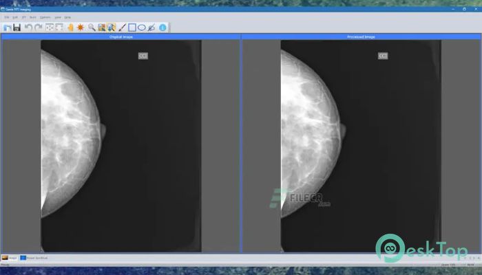Descargar Sante FFT Imaging 1.4.4 Completo Activado Gratis