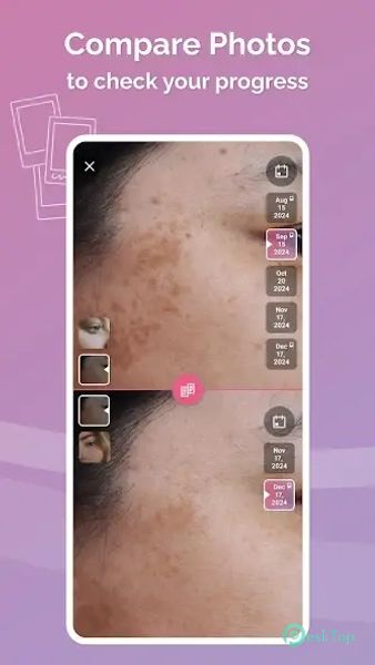 Skincare Routine: FeelinMySkin 2.4.231 APK MOD Полная бесплатная загрузка