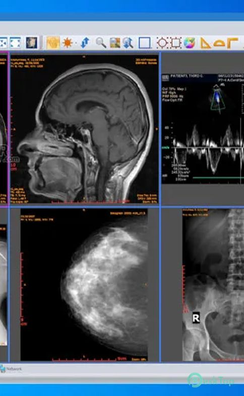 تحميل برنامج Sante DICOM Viewer 3D Pro 4.9.4 برابط مباشر